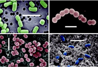 Fig. 1—Some of the lactic acid bacteria whose genomes are being sequenced. White bars are 3 microns in length. Photos courtesy of Bill McManus, Utah State University