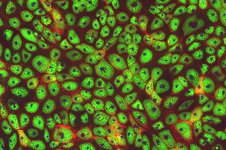 lipid loaded bluefin tuna fat cells